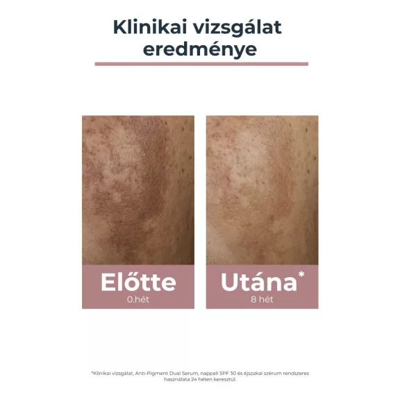 Eucerin Anti-Pigment arckrém éjszakai 50 ml Eucerin Anti-Pigment arckrém éjszakai 50 ml