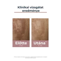 Eucerin Anti-Pigment FF30 arckrém nappali 50 ml