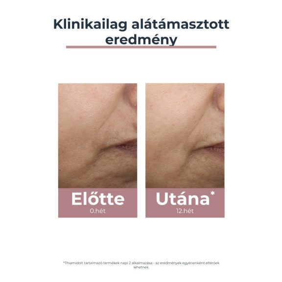 Eucerin Anti-Pigment színezett nappali arckrém medium SPF30 50 ml Eucerin Anti-Pigment színezett nappali arckrém medium SPF30 50 ml