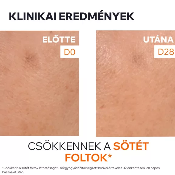 Uriage Dépiderm barna foltok elleni szérum ragyogást fokozó booster 30 ml