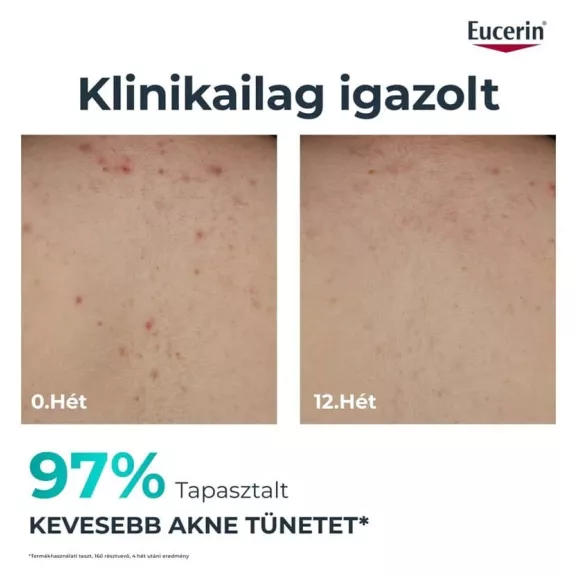 Eucerin Dermopure Clinical Correcting Body Care Testkrém 200 ml Eucerin Dermopure Clinical Correcting Body Care Testkrém 200 ml