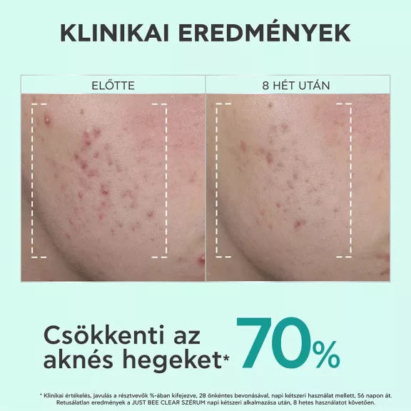 Apivita Just bee clean szérum 30 ml Apivita Just bee clean szérum 30 ml
